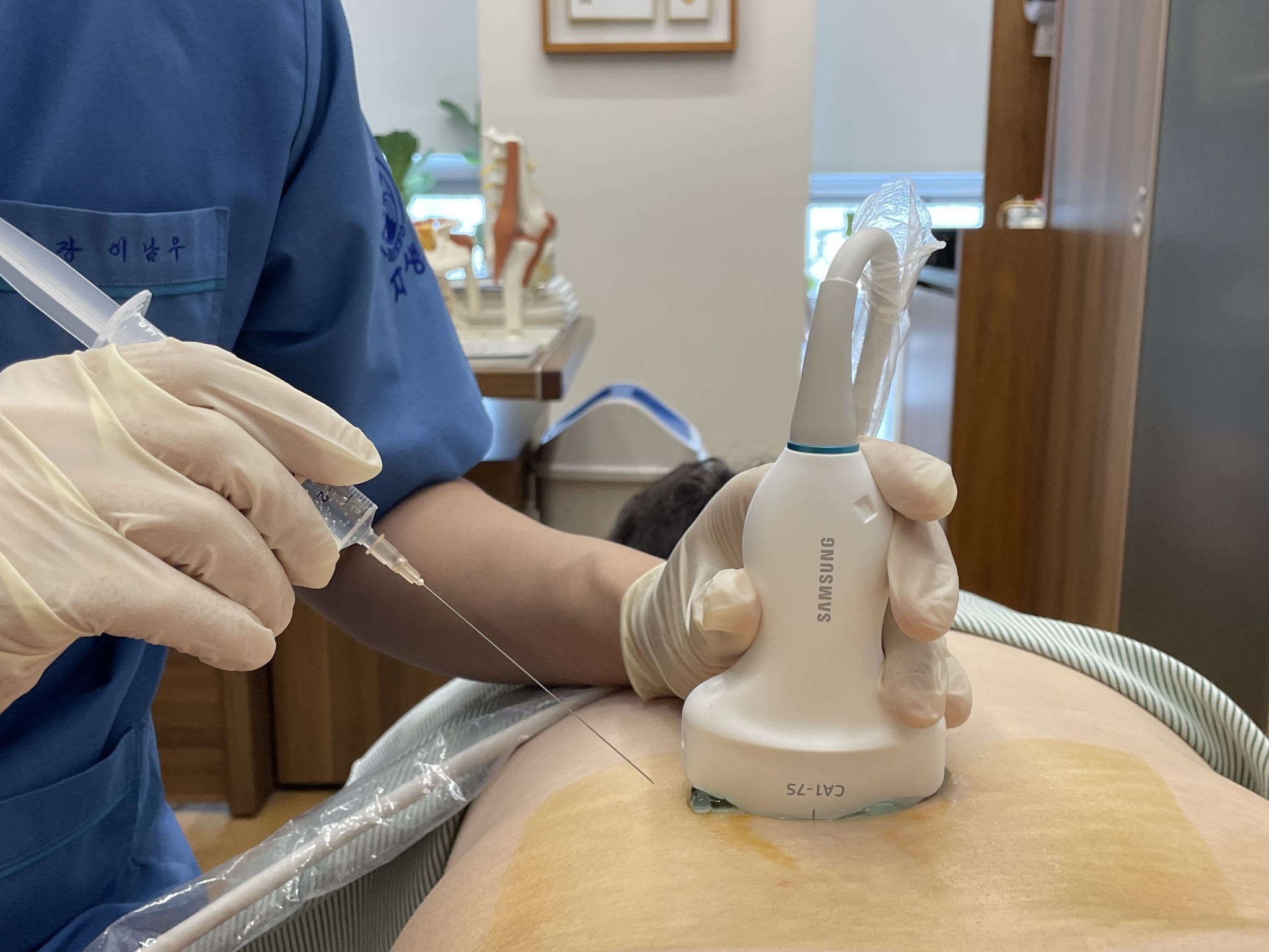 [사진설명] 초음파를 활용한 약침 치료.jpg