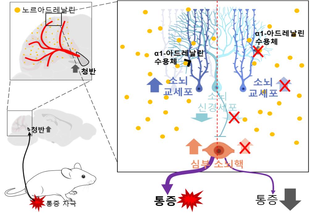 통증2.jpg