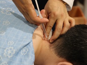 ‘목디스크’ 통증 초기에 관리해야 수술 피할 수 있어