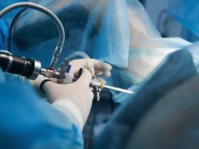 위암·대장암 내시경 검진, 80대 이상서는 효과 명확치 않아