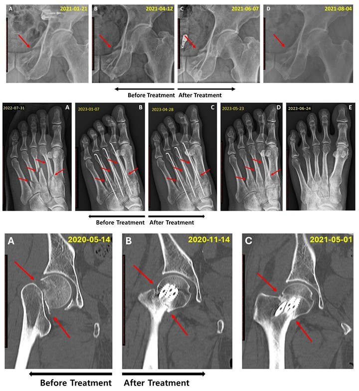한의학연 접골탕 연구_2.jpg
