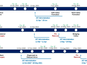 접골탕, 기존 치료 무반응인 지연유압 골절에 효과 확인