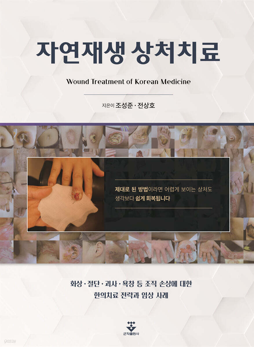 [신간] ‘자연재생 상처치료’, 외상 치료 A부터 Z까지 총망라