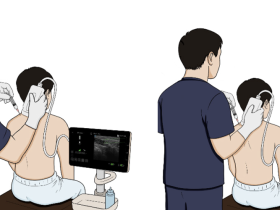 초음파 활용 약침술, 경추 근막통증 환자의 통증 감소·안전성 ‘입증’