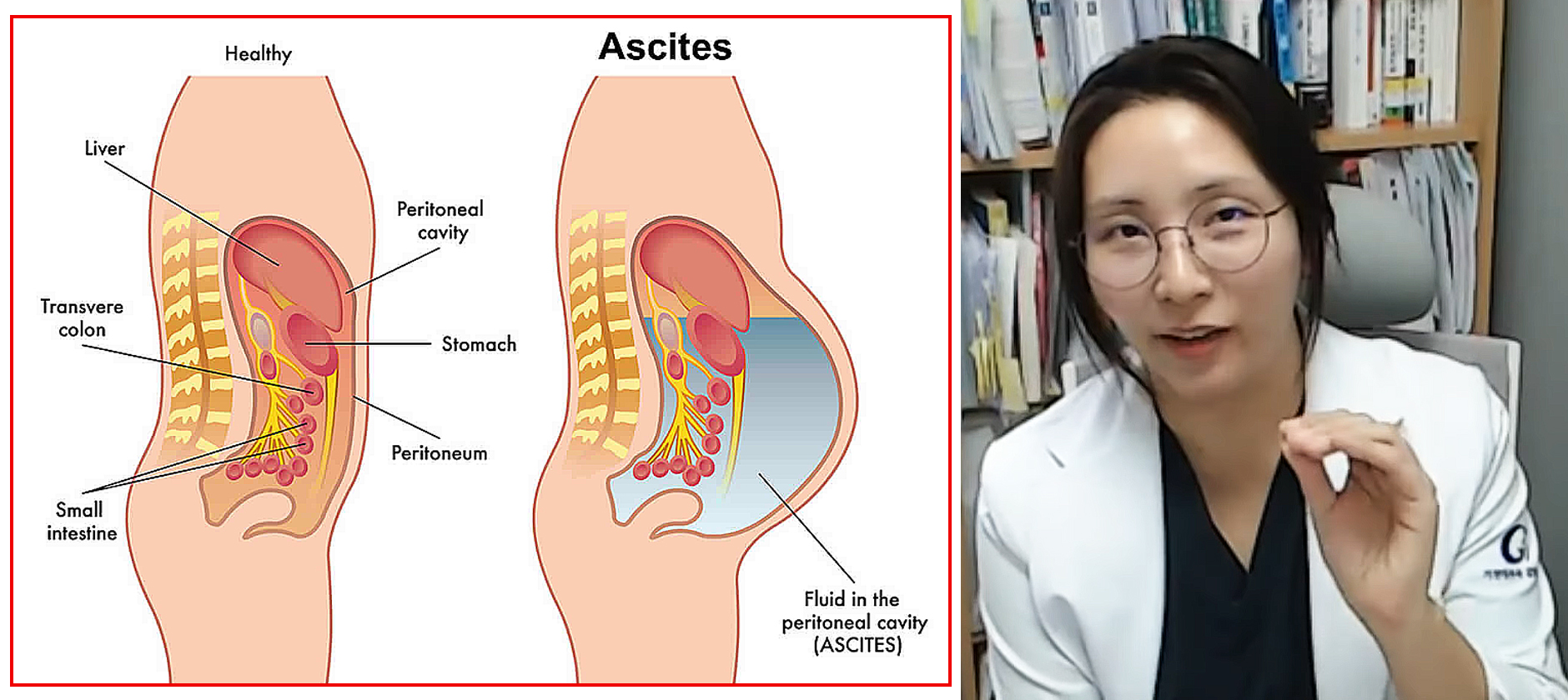 한의재택의료학회 특강.jpg