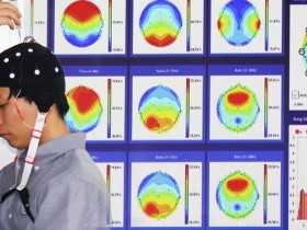 한의 뇌파 임상, AI 판독·업데이트 시스템으로 진화 가속화