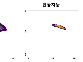 인공지능 기술 통한 이침 경혈 위치 추정 가능성 제시