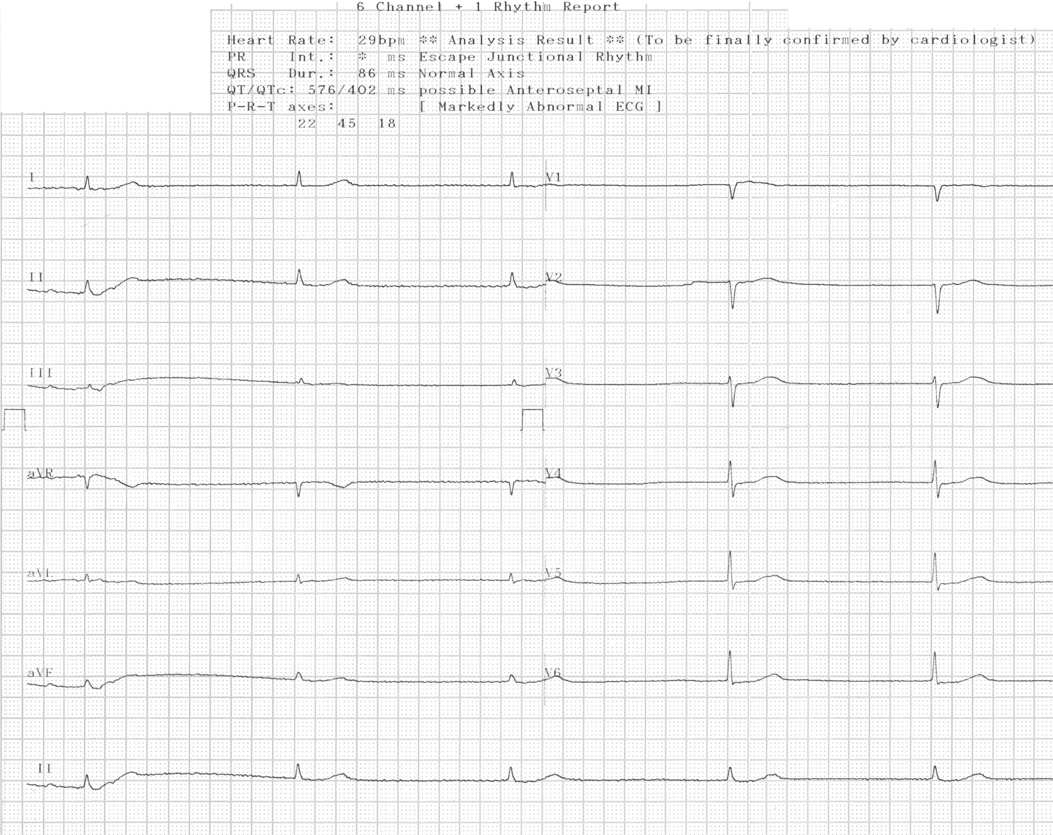 이제원 그림1.png