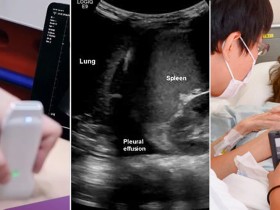 “포터블 초음파, 한의재택의료에 ‘이동성·접근성·즉각성’ 더한 진단도구”