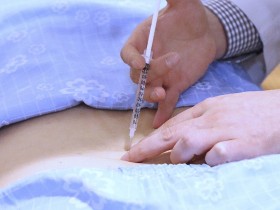 “허리디스크, 응급상황 아니라면 비수술적 치료가 좋은 대안”