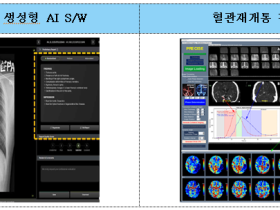 AI·빅데이터 적용 혁신의료기기 1년 새 1.5배 증가