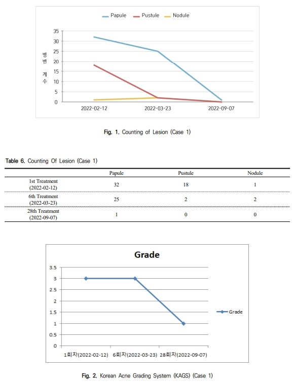 위장관 증상 치료로 모낭염까지 호전된 사례 보고