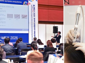 “탈모치료 시장, 약침의 ‘염증·혈류·자음’ 3축으로 패러다임 전환”