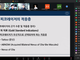 피코초 레이저 기기, 입체적 시각 통해 선택해야