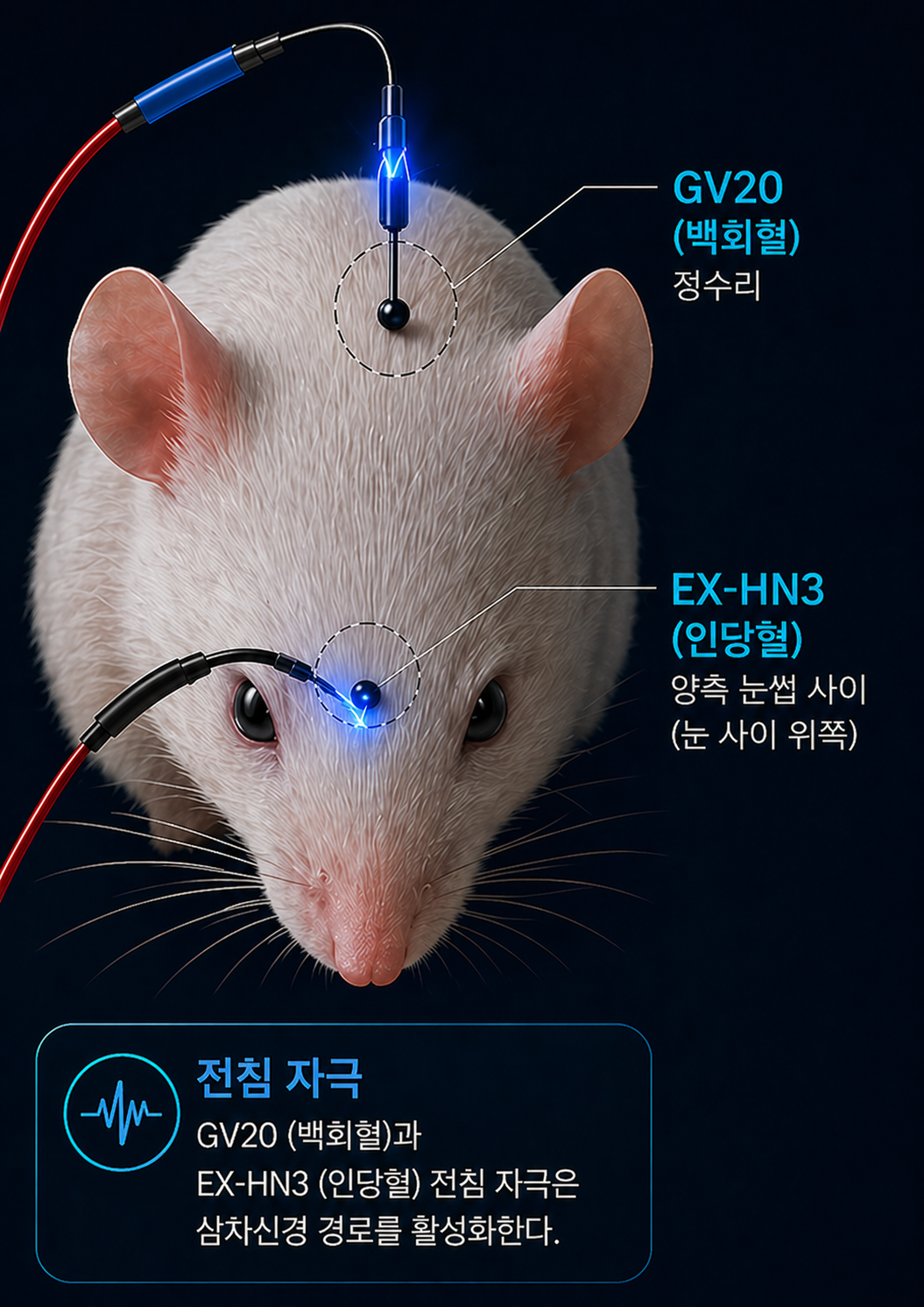 삼차신경5_전침 자극 이미지.png