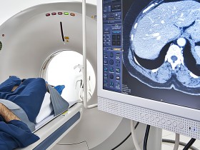 병원 옮기면 또 찍는 CT·MRI 비용 연간 650억원…건보 재정 ‘줄줄’
