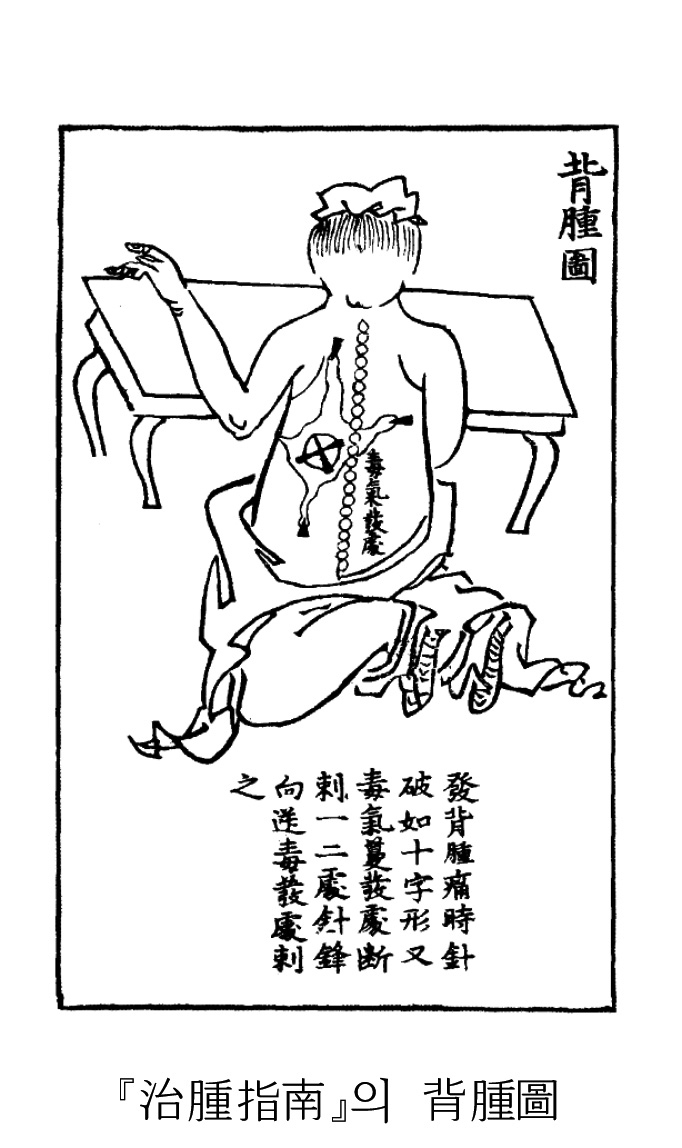 무제