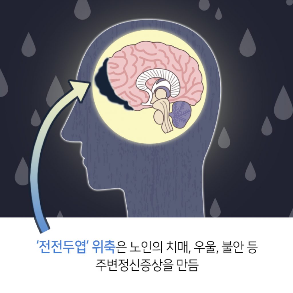 0622 불안증_수정